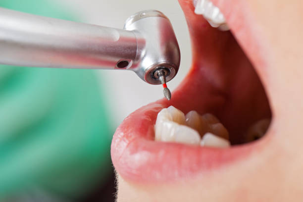Best Broken or Chipped Tooth Repair in Park Hills, MO